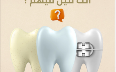 المركز الأسترالي لطب الأسنان: تجربة فريدة للعناية بأسنانك في الكويت